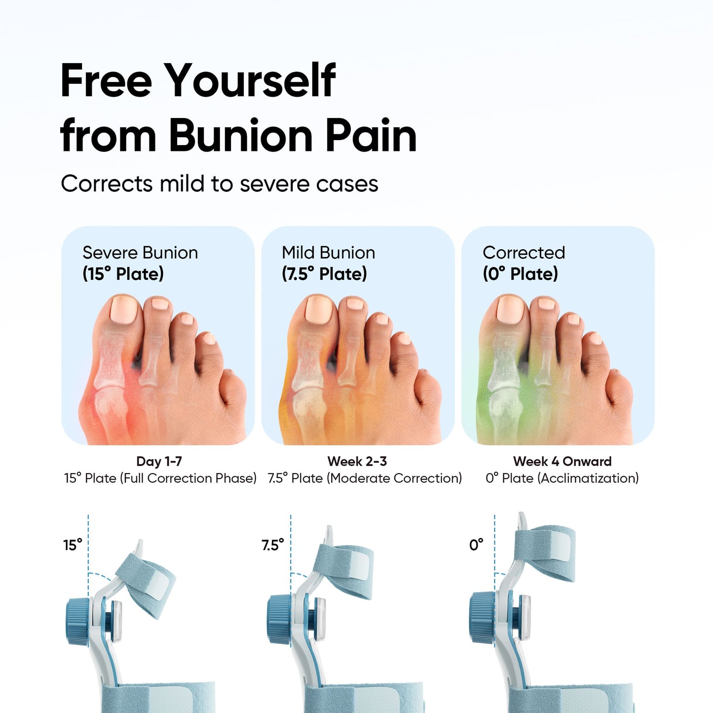 Frido Orthotics Bunion Corrector
