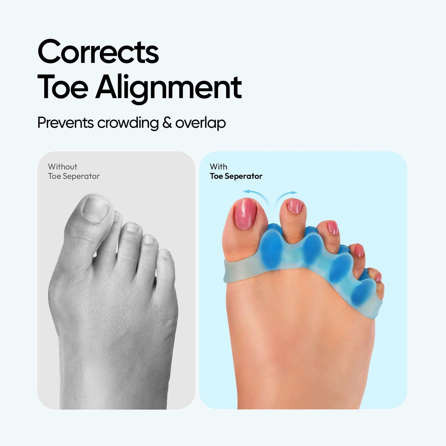 Frido Orthotics Toe Separator